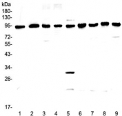 Western blot testing of rat 1) lung, 2) kidney, 3) testis, 4) PC-12 lysate and mouse 5) lung, 6) kidney, 7) testis, 8) spleen and 9) thymus lysate with GNS antibody at 0.5ug/ml. Predicted molecular weight ~62 kDa, can be observed at ~94 kDa.