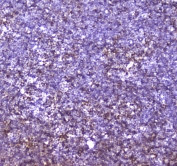 IHC testing of FFPE mouse thymus tissue with CBFB antibody at 1ug/ml. Required HIER: steam section in pH6 citrate buffer for 20 min and allow to cool prior to staining.