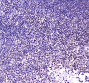 IHC testing of FFPE human tonsil tissue with CBFB antibody at 1ug/ml. Required HIER: steam section in pH6 citrate buffer for 20 min and allow to cool prior to staining.