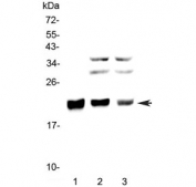 Western blot testing of 1) human SW620, 2) rat thymus and 3) mouse thymus lysate with CBFB antibody at 0.5ug/ml. Predicted molecular weight: ~22 kDa.