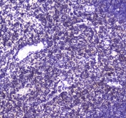 IHC testing of FFPE rat thymus tissue with CBFB antibody at 1ug/ml. Required HIER: steam section in pH6 citrate buffer for 20 min and allow to cool prior to staining.