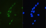 Immunofluorescent staining of FFPE human A431 cells with CBFB antibody (green) at 2ug/ml and DAPI nuclear stain (blue). HIER: steam section in pH6 citrate buffer for 20 min.