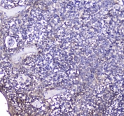 IHC testing of FFPE human tonsil tissue with BCMA antibody. HIER: boil tissue sections in pH6, 10mM citrate buffer, for 10-20 min followed by cooling at RT for 20 min.