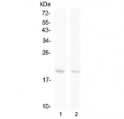 Western blot testing of human 1) Raji and 2) Jurkat cell lysate with BCMA antibody at 0.5ug/ml. Expected molecular weight: 20-27 kDa depending on glycosylation level.