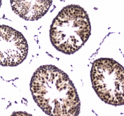 IHC testing of FFPE rat testis tissue with POLR2A antibody. HIER: boil tissue sections in pH6, 10mM citrate buffer, for 10-20 min followed by cooling at RT for 20 min.