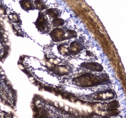 IHC testing of FFPE rat small intestine tissue with POLR2A antibody. HIER: boil tissue sections in pH6, 10mM citrate buffer, for 10-20 min followed by cooling at RT for 20 min.