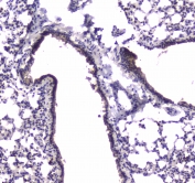 IHC testing of FFPE mouse lung tissue with PDE4D antibody. HIER: boil tissue sections in pH6, 10mM citrate buffer, for 10-20 min followed by cooling at RT for 20 min.