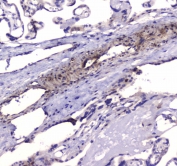IHC testing of FFPE human placental tissue with PDE4D antibody. HIER: boil tissue sections in pH6, 10mM citrate buffer, for 10-20 min followed by cooling at RT for 20 min.