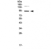 Western blot testing of human HeLa cell lysate with PDE4D antibody at 0.5ug/ml. Predicted molecular weight ~91 kDa.