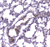 IHC testing of FFPE rat lung tissue with PDE4D antibody. HIER: boil tissue sections in pH6, 10mM citrate buffer, for 10-20 min followed by cooling at RT for 20 min.
