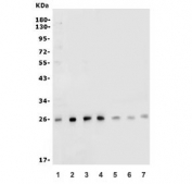 Western blot testing of human 1) PC-3, 2) HEK293, 3) MCF7, 4) ThP-1, 5) rat pancreas, 6) rat lung and 7) mouse pancreas lysate with CLPP antibody at 0.5ug/ml. Predicted molecular weight: 26-30 kDa.
