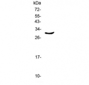 Western blot testing of human A375 cell lysate with CLPP antibody at 0.5ug/ml. Predicted molecular weight: 26-30 kDa.