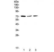 Western blot testing of human 1) HeLa, 2) MCF7 and 3) A375 cell lysate with TORC2 antibody at 0.5ug/ml. Predicted molecular weight ~73 kDa.