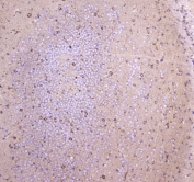 IHC testing of FFPE mouse brain tissue with WWOX antibody at 1ug/ml. Required HIER: steam section in pH6 citrate buffer for 20 min and allow to cool prior to staining.