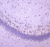 IHC testing of FFPE rat brain tissue with WWOX antibody at 1ug/ml. Required HIER: steam section in pH6 citrate buffer for 20 min and allow to cool prior to staining.