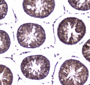 IHC testing of FFPE rat tesis tissue with WWOX antibody at 1ug/ml. Required HIER: steam section in pH6 citrate buffer for 20 min and allow to cool prior to staining.