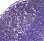 IHC testing of FFPE mouse lymph node tissue with USP7 antibody at 1ug/ml. Required HIER: steam section in pH6 citrate buffer for 20 min and allow to cool prior to staining.