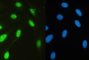 IF/ICC staining of FFPE human U-2 OS cells with USP7 antibody (green) at 2ug/ml and DAPI nuclear stain (blue). HIER: steam section in pH6 citrate buffer for 20 min.
