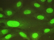 IF/ICC staining of FFPE human U-2 OS cells with USP7 antibody (green) at 2ug/ml. HIER: steam section in pH6 citrate buffer for 20 min.