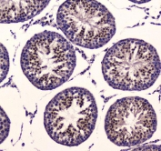 IHC testing of FFPE rat testis tissue with PDK1 antibody at 1ug/ml. Required HIER: steam section in pH6 citrate buffer for 20 min and allow to cool prior to staining.