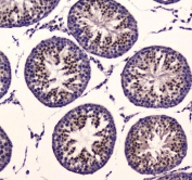 IHC testing of FFPE rat testis tissue with PDK1 antibody at 1ug/ml. Required HIER: steam section in pH6 citrate buffer for 20 min and allow to cool prior to staining.