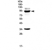 Western blot testing of human SW620 cell lysate with BRD7 antibody at 0.5ug/ml. Predicted molecular weight ~74 kDa, observed here at ~90 kDa.
