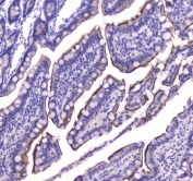 IHC testing of FFPE rat small intestine tissue with CB1 antibody at 1ug/ml. Required HIER: steam section in pH6 citrate buffer for 20 min and allow to cool prior to staining.