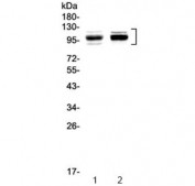 Western blot testing of 1) rat thymus and 2) mouse thymus with SATB1 antibody at 0.5ug/ml. Predicted molecular weight ~86 kDa, routinely observed at 100~110 kDa.
