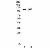 Western blot testing of 1) rat brain and 2) mouse brain lysate with STAT2 antibody at 0.5ug/ml. Expected molecular weight: 98-113 kDa depending on phosphorylation level.