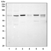Western blot testing of 1) human HCT116, 2) human HeLa, 3) rat liver, 4) rat kidney, 5) mouse liver and 6) mouse kidney tissue lysate with SPHK2 antibody at 0.5ug/ml. Predicted molecular weight ~69 kDa.
