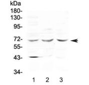 Western blot testing of human 1) COLO-320, 2) HepG2 and 3) 22RV1 cell lysate with SPHK2 antibody at 0.5ug/ml. Predicted molecular weight ~69 kDa.