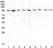 Western blot testing of human 1) HeLa, 2) placenta, 3) HepG2, 4) SGC-7901, 5) 22RV1, 6) rat lung, 7) mouse lung, 8) mouse testis and 9) mouse ovary with RALBP1 antibody at 0.5ug/ml. Predicted molecular weight ~76 kDa, observed molecular weight: 90-95 kDa.