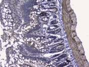 IHC staining of FFPE rat small intestine with RALBP1 antibody. HIER: boil tissue sections in pH6, 10mM citrate buffer, for 20 min and allow to cool before testing.