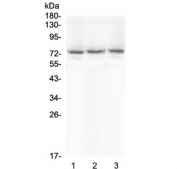 Western blot testing of human 1) COLO-320, 2) HepG2 and 3) A549 cell lysate with SCNN1A antibody at 0.5ug/ml. Predicted molecular weight ~76 kDa.