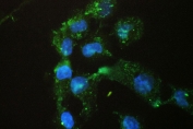 Immunofluorescent staining of FFPE human A431 cells with SCNN1A antibody (green) and DAPI nuclear stain (blue). HIER: steam section in pH6 citrate buffer for 20 min.