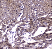 IHC testing of FFPE rat heart tissue with ESRRG antibody at 1ug/ml. Required HIER: steam section in pH6 citrate buffer for 20 min and allow to cool prior to staining.