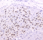IHC testing of FFPE mouse brain tissue with ESRRG antibody at 1ug/ml. Required HIER: steam section in pH6 citrate buffer for 20 min and allow to cool prior to staining.