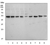 Western blot testing of 1) human HepG2, 2) human A549, 3) human MOLT4, 4) human RT4, 5) human Daudi, 6) human K562, 7) rat kidney, 8) mouse kidney and 9) mouse colon tissue lysate with Glutathione Reductase antibody. Predicted molecular weight ~55 kDa.