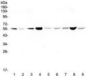Western blot testing of rat 1) spleen, 2) lung, 3) liver, 4) kidney and mouse 5) spleen, 6) lung, 7) liver, 8) kidney and 9) testis lysate with Glutathione Reductase antibody at 0.5ug/ml. Predicted molecular weight ~55 kDa.