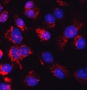 Immunofluorescent staining of FFPE human A549 cells with Glutathione Reductase antibody (red) and DAPI nuclear stain (blue). HIER: steam section in pH6 citrate buffer for 20 min.