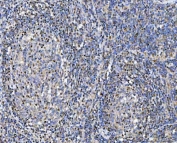 IHC staining of FFPE human tonsil tissue with Glutathione Reductase antibody. HIER: boil tissue sections in pH8 EDTA for 20 min and allow to cool before testing.