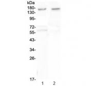 Western blot testing of human 1) U-87 MG and 2) SHG-4 cell lysate with Neurexin antibody at 0.5ug/ml. Predicted molecular weight ~162 kDa.