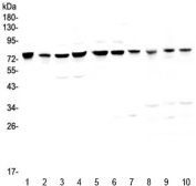 Western blot testing of human 1) HeLa, 2) placenta, 3) COLO-320, 4) HepG2, 5) PANC-1, 6) SGC-7901, 7) MBA-MD-231, 8) rat kidney, 9) mouse heart and 10) mouse kidney with PARN antibody at 0.5ug/ml. Predicted molecular weight ~73 kDa.