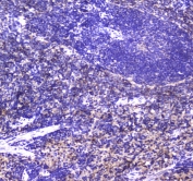 IHC testing of FFPE rat spleen tissue with NKp46 antibody at 1ug/ml. Required HIER: steam section in pH6 citrate buffer for 20 min and allow to cool prior to staining.