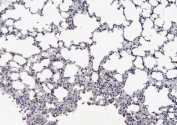 IHC testing of FFPE mouse lung tissue with NKp46 antibody at 1ug/ml. Required HIER: steam section in pH6 citrate buffer for 20 min and allow to cool prior to staining.
