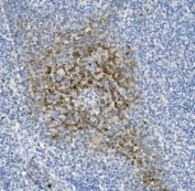 IHC staining of FFPE human tonsil tissue with NKp46 antibody. HIER: boil tissue sections in pH8 EDTA for 20 min and allow to cool before testing.