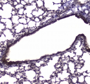 IHC testing of FFPE mouse lung tissue with NFIB antibody at 1ug/ml. Required HIER: steam section in pH6 citrate buffer for 20 min and allow to cool prior to staining.