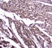 IHC testing of FFPE rat heart tissue with NFIB antibody at 1ug/ml. Required HIER: steam section in pH6 citrate buffer for 20 min and allow to cool prior to staining.