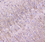 IHC testing of FFPE rat brain tissue with LC3A antibody at 1ug/ml. Required HIER: steam section in pH6 citrate buffer for 20 min and allow to cool prior to staining.