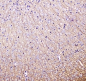 IHC testing of FFPE mouse brain tissue with LC3A antibody at 1ug/ml. Required HIER: steam section in pH6 citrate buffer for 20 min and allow to cool prior to staining.